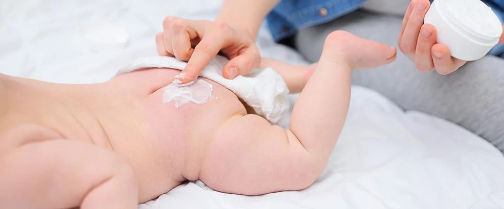 How to prevent diaper rash in adults